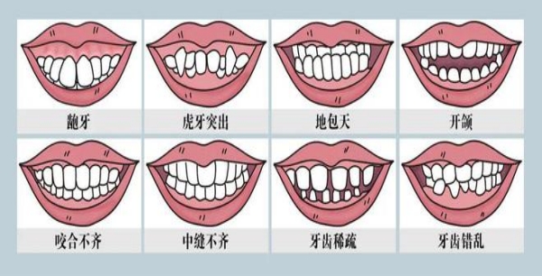 錯颌畸形可(kě)不可(kě)以預防