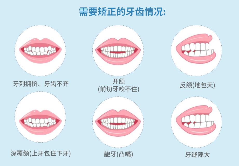 錯颌畸形有(yǒu)哪些危害