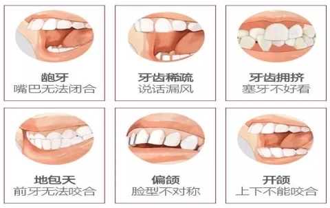 如何防治孩子的錯颌畸形