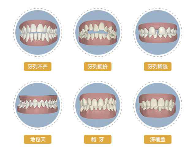 功能(néng)矯治後複發的主要原因