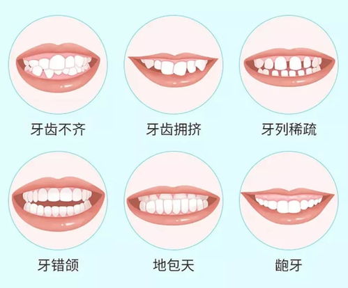 錯颌畸形的預防矯治是什麽