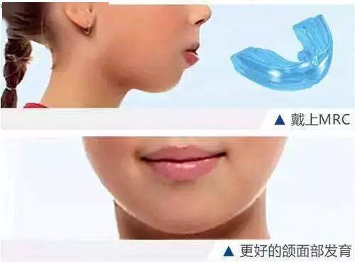 常見的矯治方法有(yǒu)哪些