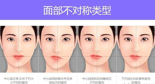 牙颌面畸形的病因